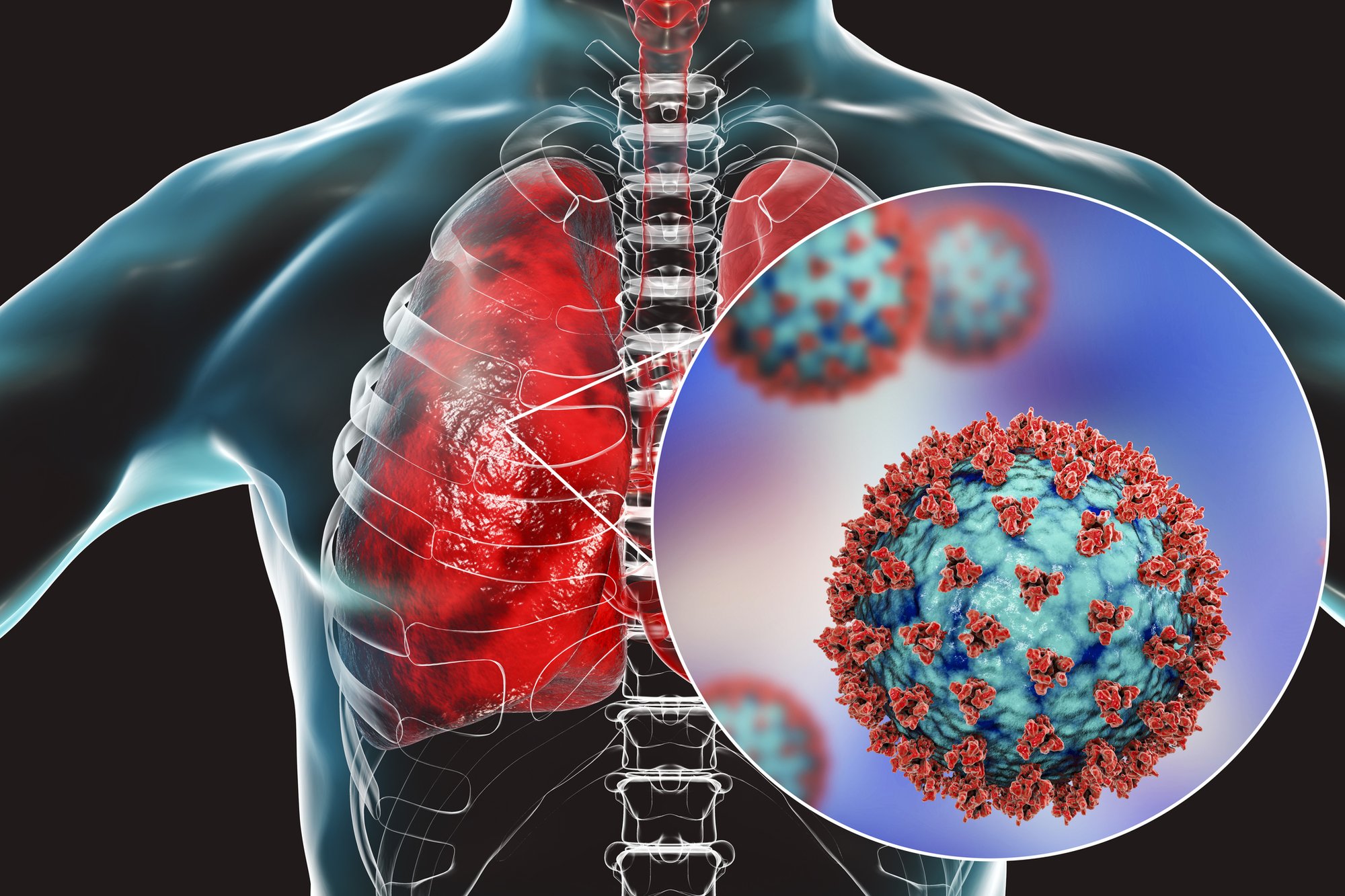 Recent Infection Health Blog