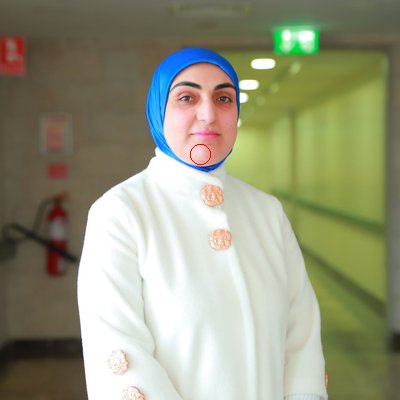 د. أنوار زبن