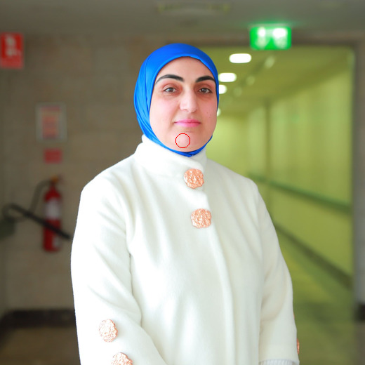 د. أنوار زبن